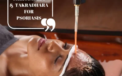 Ayurveda Treatment to Prevent Psoriasis Flare up